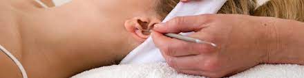 Curso de auriculoterapia